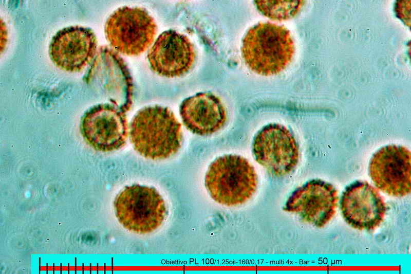 lycogala_epidedrum_2396_11.jpg