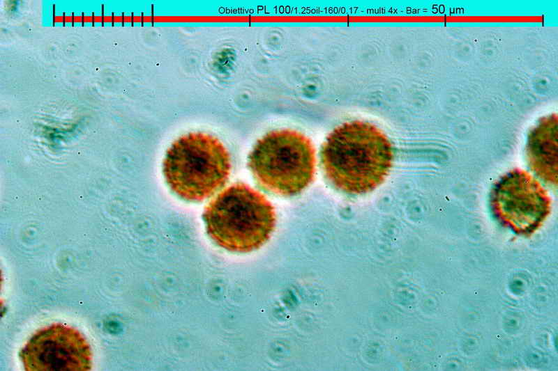 lycogala_epidedrum_2396_12.jpg