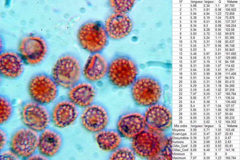 lycogala_epidedrum_2396_13.jpg