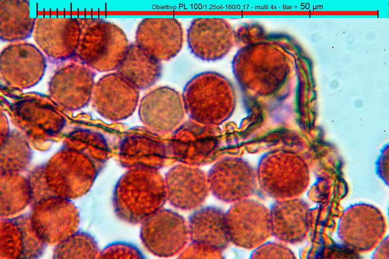 lycogala_terrestre_3271_05.jpg