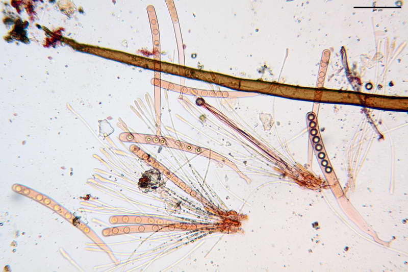 scutellinia_trechispora_4446_20.JPG