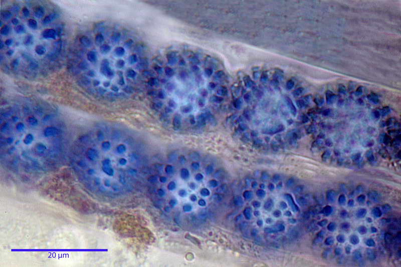 scutellinia_trechispora_4446_39.jpg