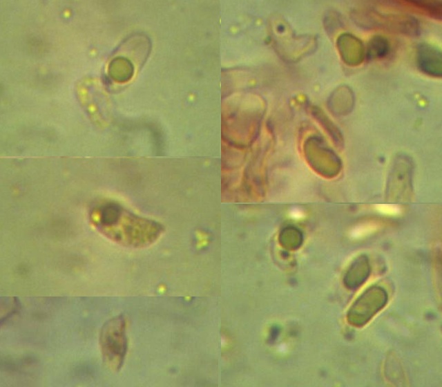 SSpore_0 (x100).jpg